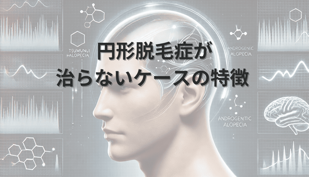 円形脱毛症　治らない