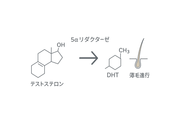 DHT変換と薄毛進行メカニズム｜5αリダクターゼの作用