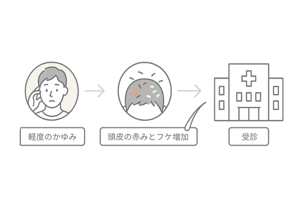 かゆみ・薄毛が続くとき受診を検討すべきサイン