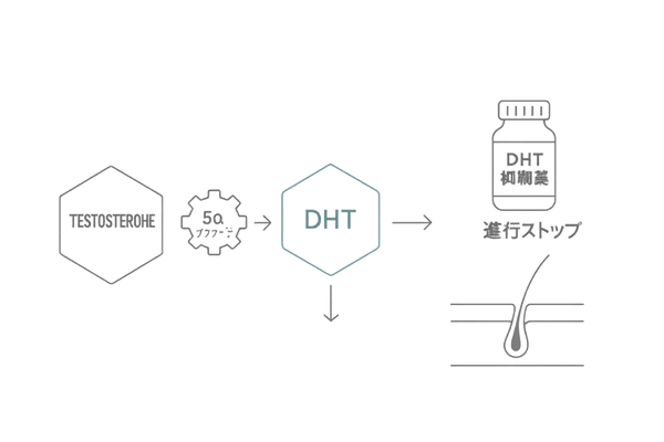 テストステロン・DHTとAGA治療の仕組み解説イラスト