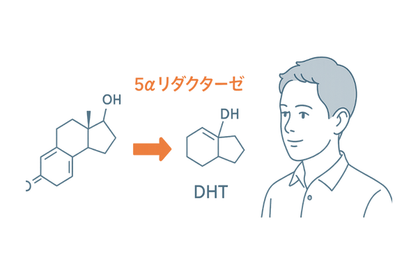 テストステロンからDHTへの変換がM字型薄毛を招く仕組み図