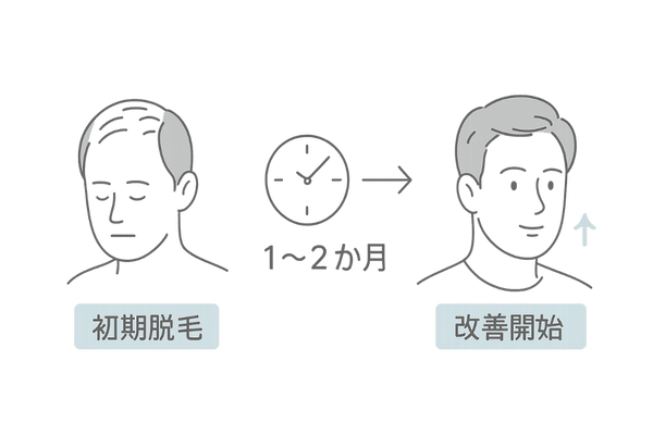 AGA治療のタイムライン|初期脱毛から改善までを示す線画イメージ