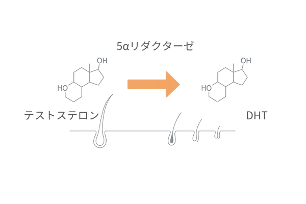 DHT生成と毛根への影響を示す図