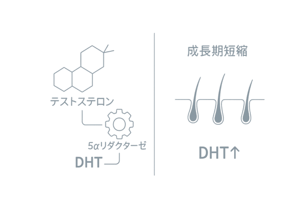 DHTによる生え際後退メカニズム|AGA原因イラスト