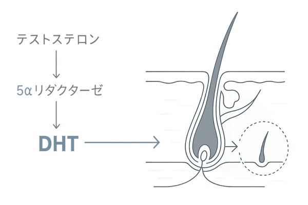 AGAのメカニズムを示すイラスト|テストステロンとDHTの作用