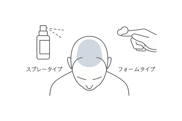ミノキシジル外用薬 スプレーとフォームの使用方法イラスト