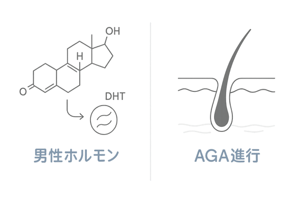 AGA進行メカニズムと男性ホルモンの関係を示す図