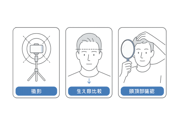 M字型の進行を見逃さないセルフチェック（標準化撮影・生え際比較・頭頂部確認）