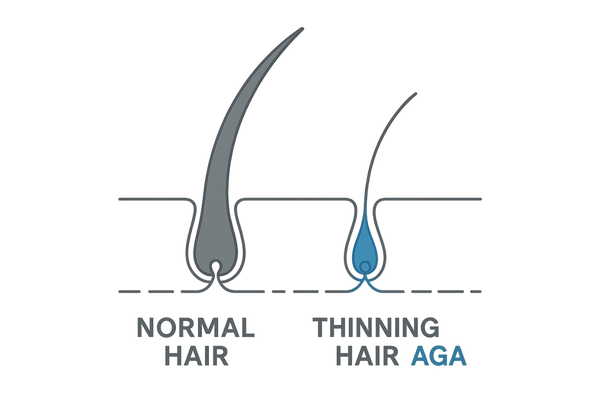 通常のヘアサイクルで抜けた髪とAGAによる細い抜け毛を比較したイラスト