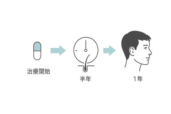 AGAの治療期間とヘアサイクル図