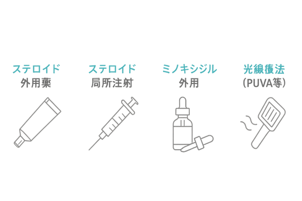 円形脱毛症の治療法イラスト比較:ステロイド外用・局所注射・ミノキシジル・光線療法