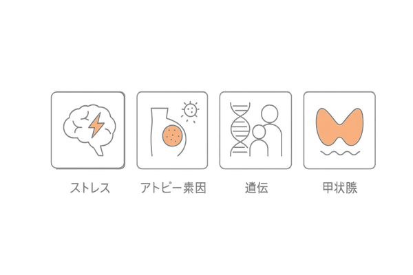 円形脱毛症の再発リスク要因|ストレス・アトピー素因・遺伝・甲状腺