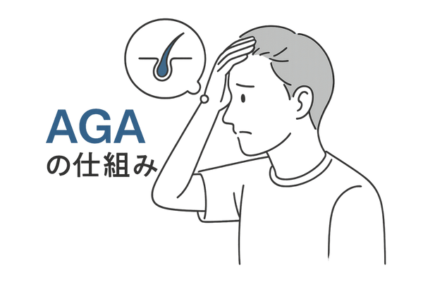 AGAの仕組み
