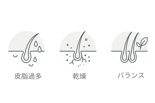 頭皮タイプ別特徴と薄毛リスク比較イラスト
