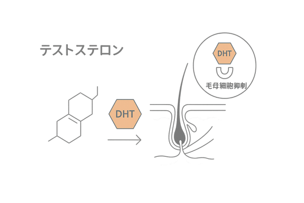 AGAの進行メカニズムを示すDHT作用イラスト