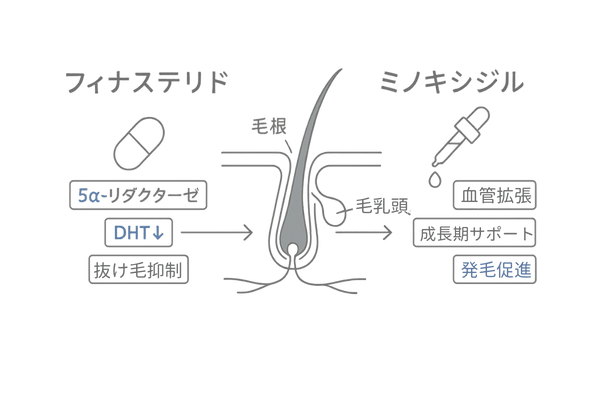 ミノフィナの作用機序図解｜ミノキシジルとフィナステリドの役割（通販購入前に知る基礎）