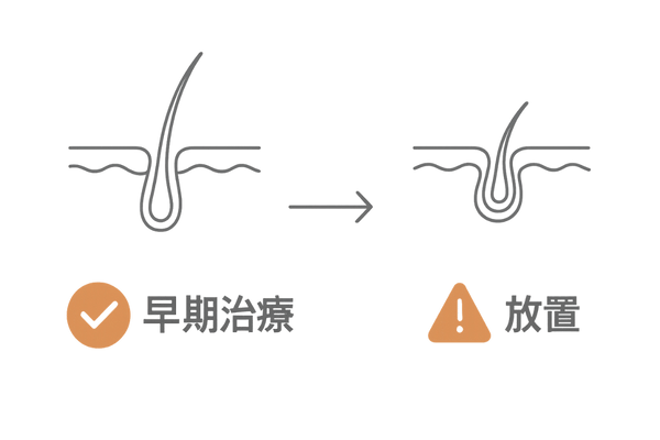 早期治療で守る毛根ダメージ進行比較