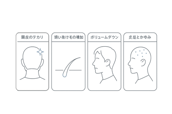 後頭部ハゲの進行サイン|テカリ・短い抜け毛・ボリューム低下・炎症の4アイコン