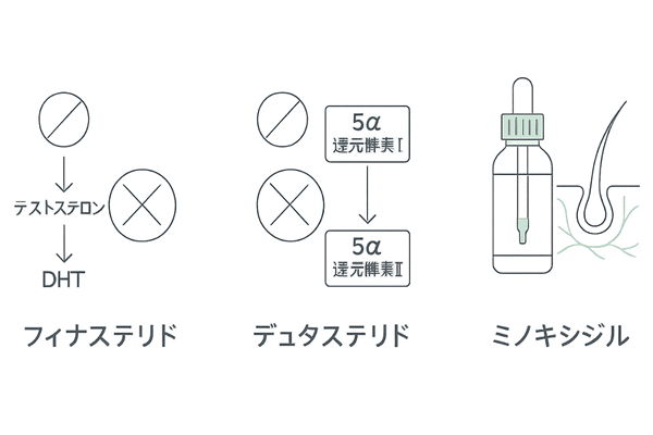 AGA治療の主要薬のイメージ図|フィナステリド・デュタステリド・ミノキシジルの作用ポイント