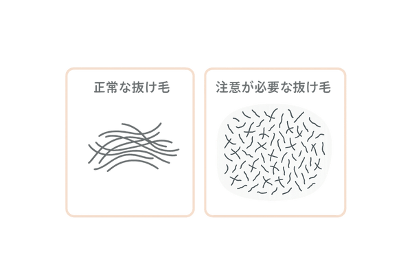 正常と異常な抜け毛の違いを示す比較イラスト