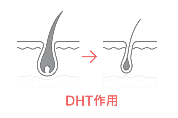 DHTによる毛包ミニチュア化の比較イラスト