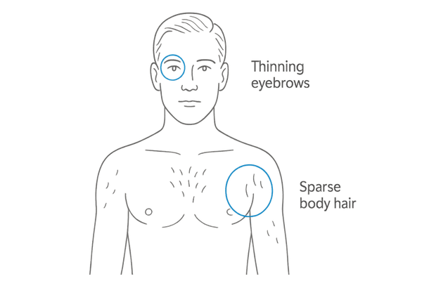 男性の眉と体毛の薄化