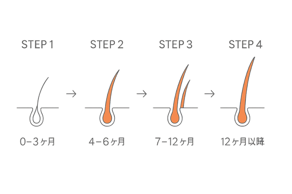 デュタステリドの効果実感タイムライン|0~12か月の主な変化イメージ