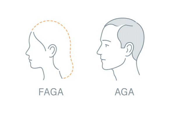 FAGAとAGAの違い比較｜女性と男性の脱毛パターン
