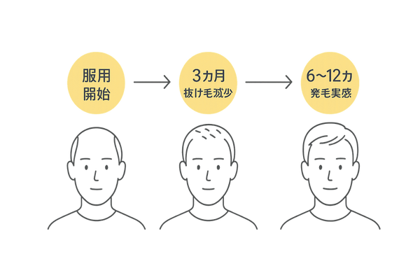 フィナロイド服用後の効果タイムライン