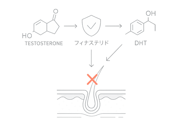 フィナステリドがDHT生成を阻害する仕組みを示すイラスト