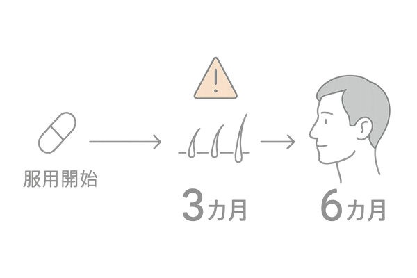 フィンペシア効果と副作用のタイムライン|3カ月・6カ月の変化を示すイラスト