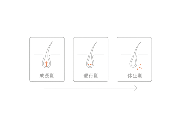 髪の成長サイクルを示す3ステージタイムライン図