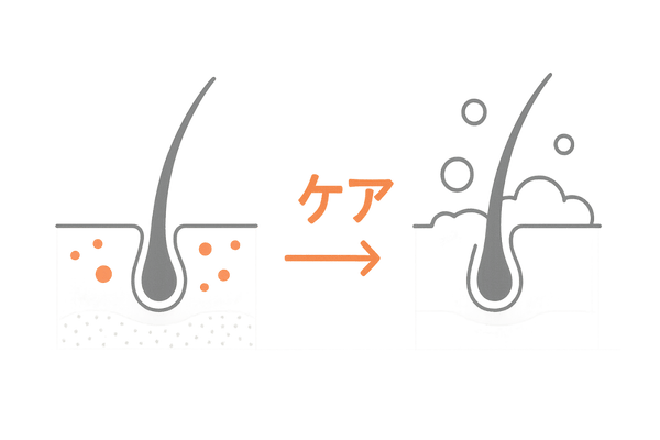 高校生の頭皮トラブルに対するセルフケアイラスト