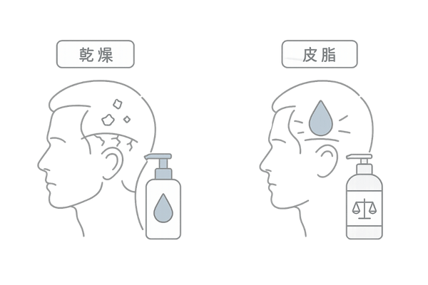 頭皮タイプ別の対処法(乾燥・皮脂でのケア選択)
