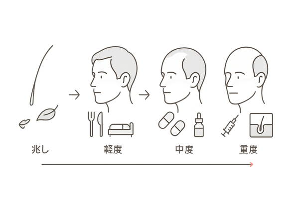 薄毛の進行度別対処法タイムライン｜軽度・中度・重度の治療開始の目安