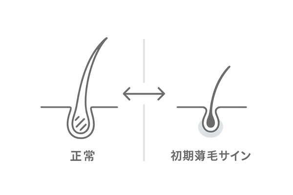 抜け毛が増える初期サイン:正常毛とミニチュア化毛の比較イラスト