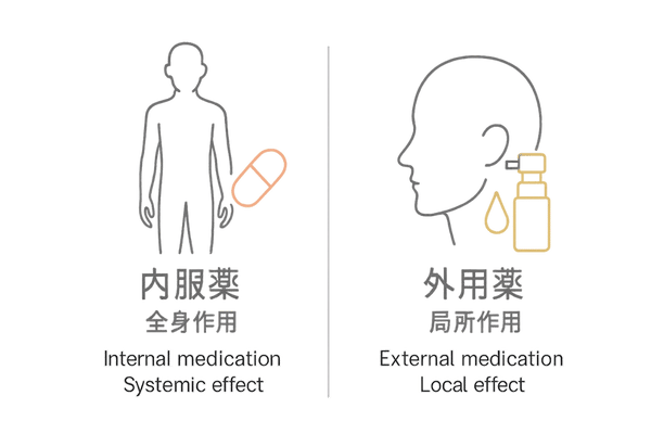 内服薬と外用薬を比較するAGA治療オプションイラスト