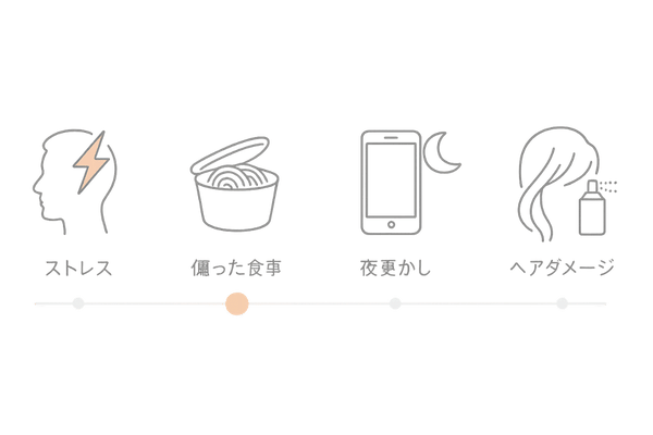 20代男性に多い抜け毛原因のタイムラインイラスト