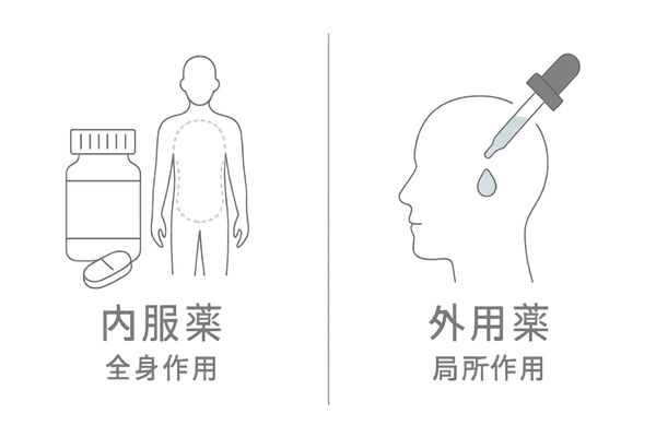 20代薄毛治療 内服薬と外用薬の比較カード