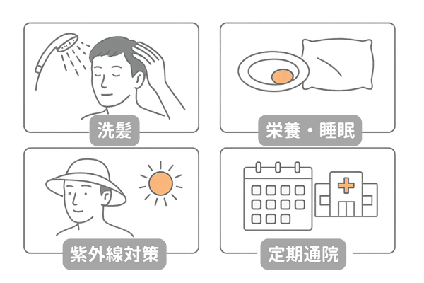 植毛後ケアのポイント図解(洗髪・栄養睡眠・紫外線対策・定期通院の2×2ミニカード)