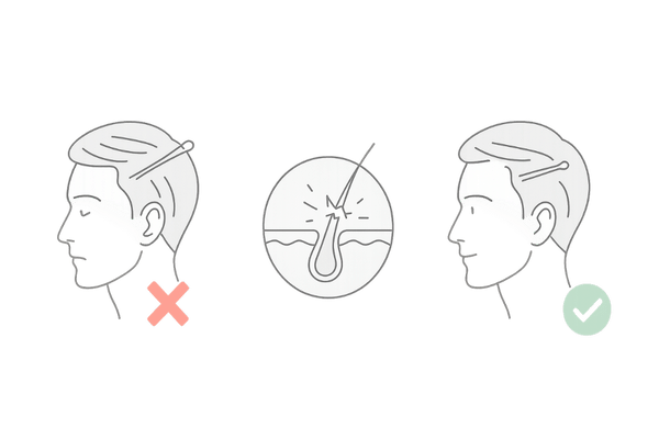 ヘアピン先端刺激と安全な丸型ピンの使い方比較図