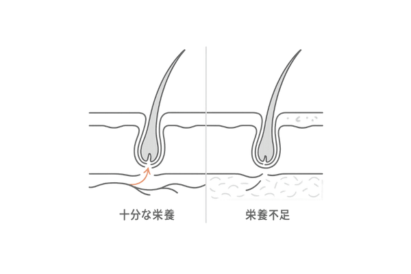 抜け毛と栄養の関係｜頭皮断面で見る栄養不足による頭皮環境の乱れ