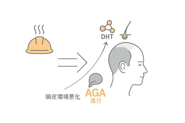 AGA悪化リスクを高めるヘルメット習慣フロー図