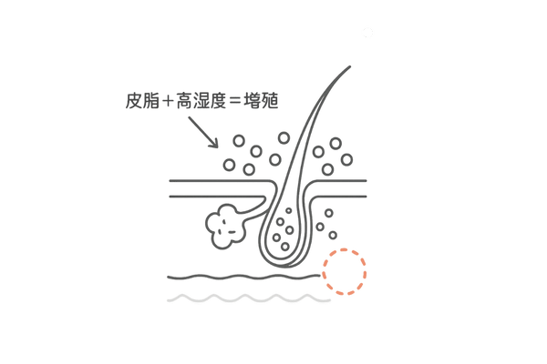 皮脂を好むマラセチア菌と毛包断面図