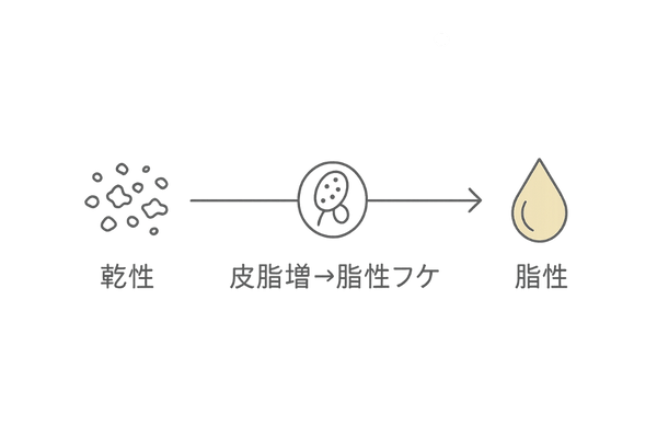 乾性フケ vs 脂性フケの比較アイコン