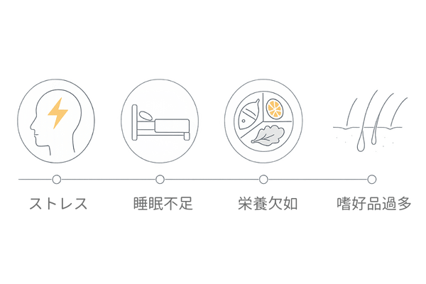 ストレス・生活習慣と薄毛リスクの関係フロー