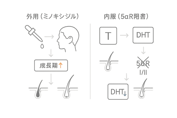 医療用発毛治療の作用機序|ミノキシジル外用と内服(フィナステリド/デュタステリド)の比較フロー