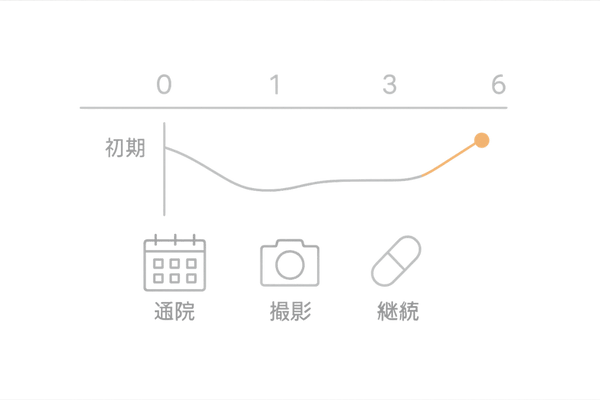 発毛治療の継続プラン|0〜6か月の効果判定タイムラインと通院サイクル
