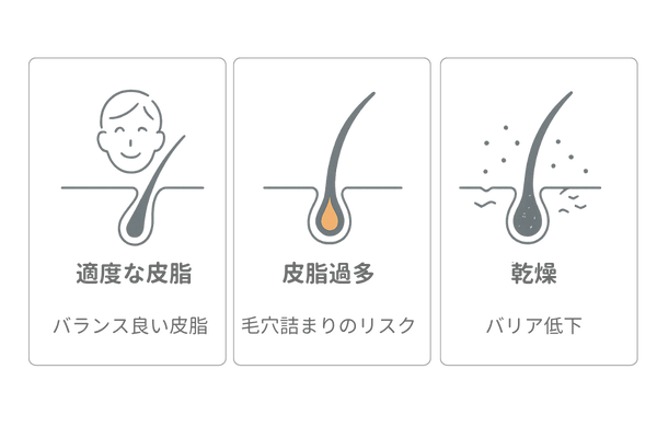 40代男性の頭皮状態の違い(適度な皮脂・皮脂過多・乾燥)の比較イラスト