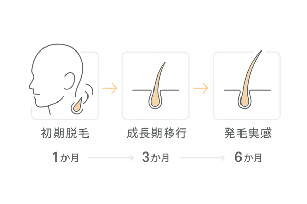 ミノキシジル内服治療経過の3ステージ図(初期脱毛~発毛)